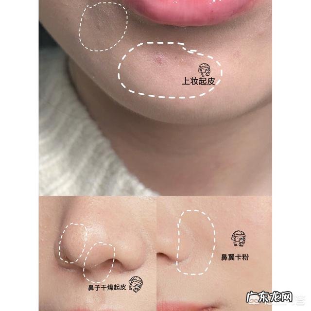 换季皮肤干燥起皮，应该如何护肤