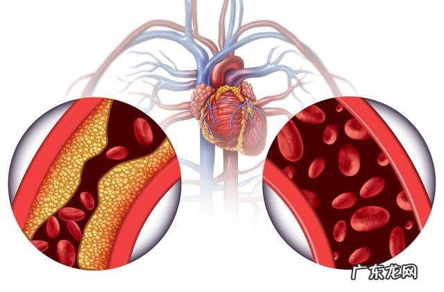 猪肉是造成心脑血管疾病的罪魁祸首吗?