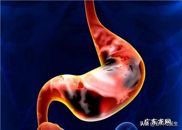 慢性胃炎患者早上能跑步吗