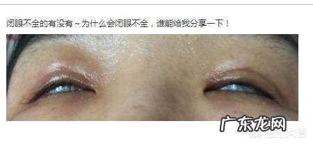 对于割双眼皮,你怎么看?