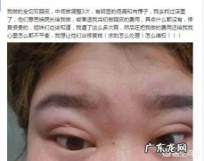 对于割双眼皮，你怎么看？