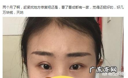 对于割双眼皮,你怎么看?