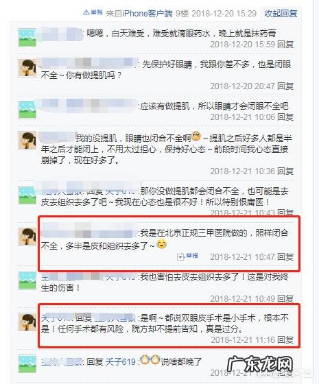 对于割双眼皮,你怎么看?