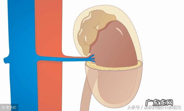 肾上腺肿瘤一定要手术吗?