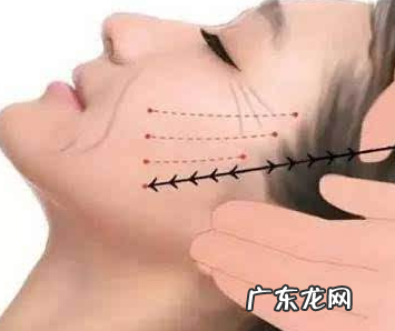 做线雕二十天后可以减肥吗