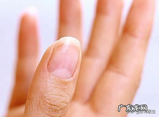 指甲表面有明显的竖纹是怎么回事?