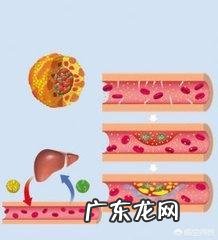 冠心病是大病吗，可不可以列入慢牲病范畴？