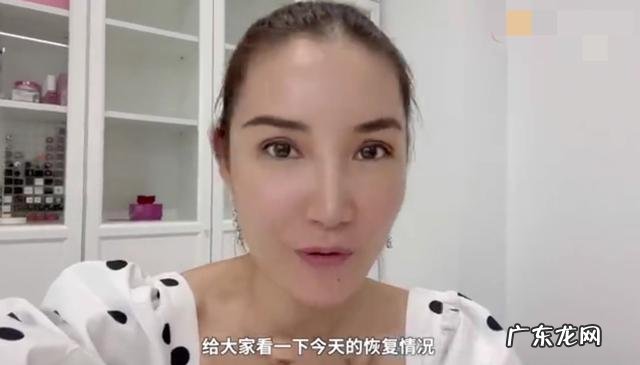 央视主持人允许整容吗 央视割过双眼皮的主持人