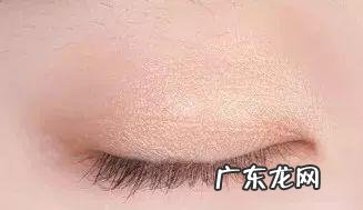 割双眼皮留疤图片 双眼皮手术怎么样会留疤