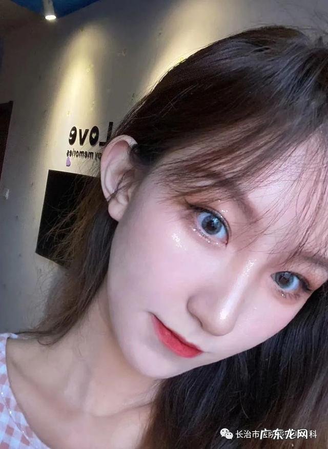 割双眼皮提升术 双眼皮收紧术