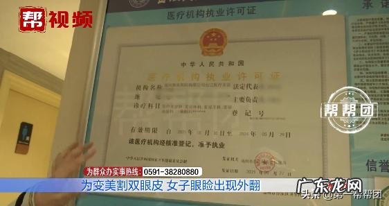 割双眼皮亲身经验 上海割双眼皮过程