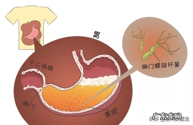 糜烂性胃炎，现在一吃东西就胃胀，该怎么办？ 糜烂性胃炎吃点饭就胀怎么办