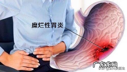 糜烂性胃炎，现在一吃东西就胃胀，该怎么办？ 糜烂性胃炎吃点饭就胀怎么办