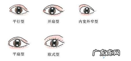双眼皮手术主要有三种 常见的双眼皮手术方法有哪几种啊