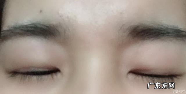 萧山第一人民医院双眼皮 萧山微创双眼皮多少钱