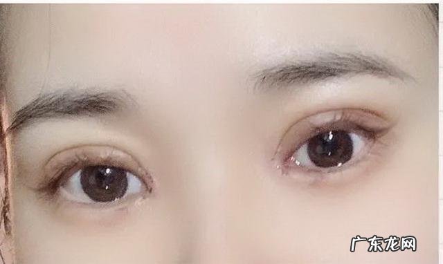 萧山第一人民医院双眼皮 萧山微创双眼皮多少钱