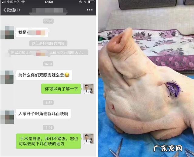 切双眼皮术要多少钱啊 做双眼皮术大概多少钱啊