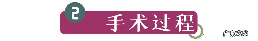 割完双眼皮5个月后的效果 割完双眼皮25天效果