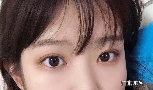 割完双眼皮5个月后的效果 割完双眼皮25天效果