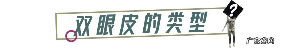割完双眼皮5个月后的效果 割完双眼皮25天效果