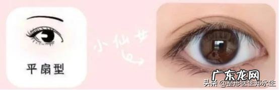 双眼皮手术的几种类型和建议 双眼皮手术三种方法的优缺点
