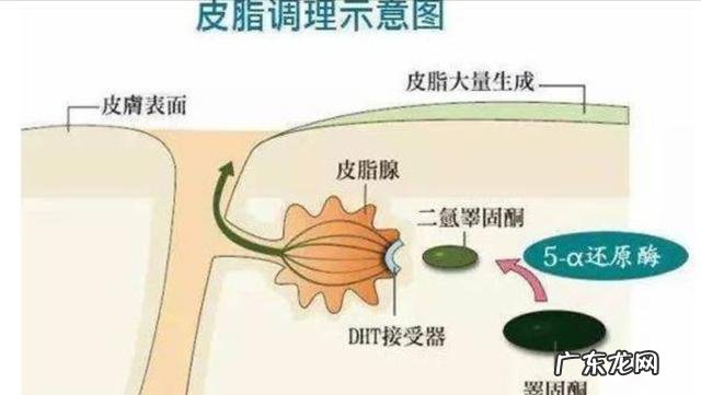 男性秃头白发 男子头发一洗就秃头