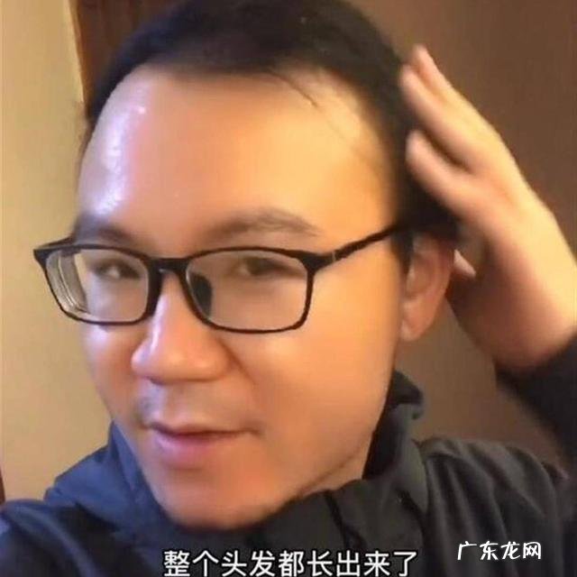 男性秃头白发 男子头发一洗就秃头