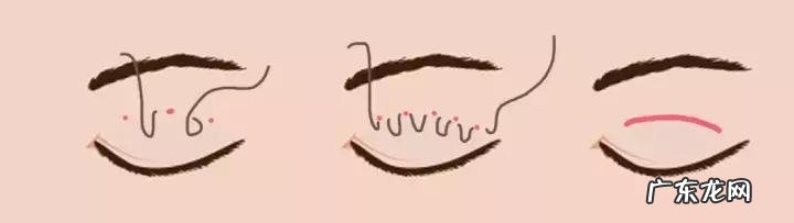 做双眼皮其实很简单 做双眼皮是怎么做得更好