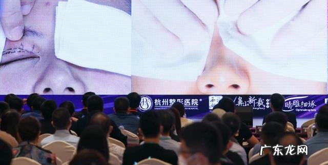 介绍双眼皮话术 仿生双眼皮话术