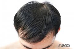 脱发的人用洗发水真的能生发吗 不脱发可以用生发的洗发水吗