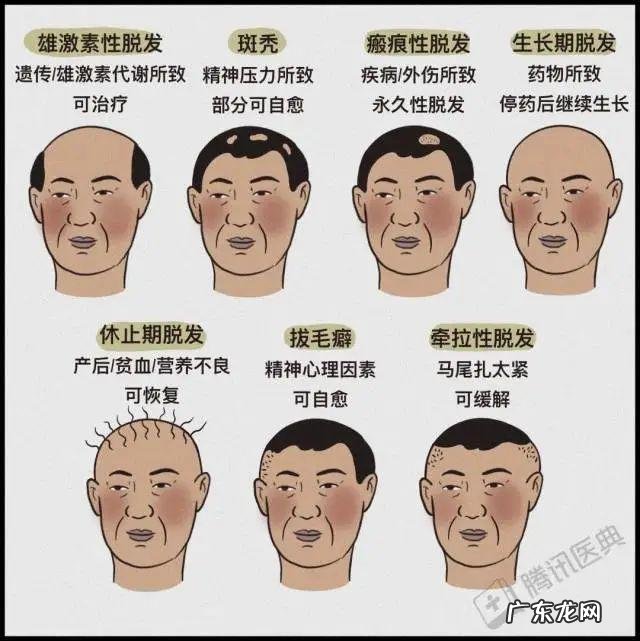 6年不用洗发水实测 男子秃顶后坚持半个月不用洗发水