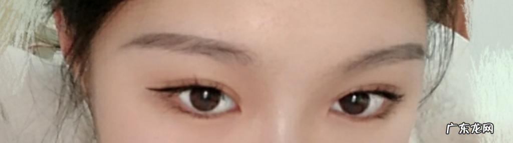 双眼皮手术 双眼皮手术有几种做法