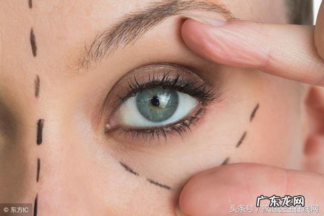 五一适合割双眼皮吗 暑假适合割双眼皮吗