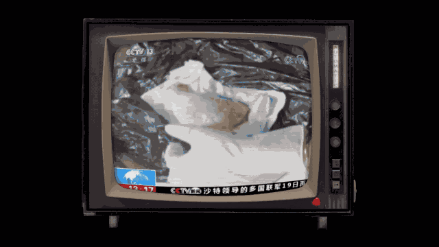 双眼皮手术一年的经验 双眼皮手术经验分享