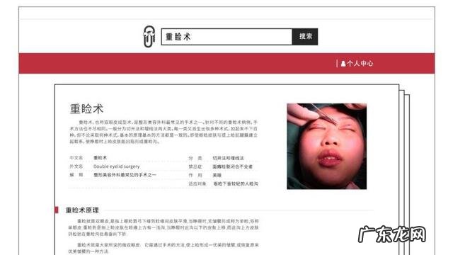 双眼皮手术一年的经验 双眼皮手术经验分享