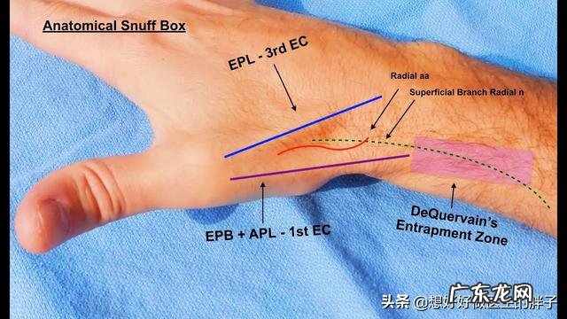 婴幼儿大拇指腱鞘炎需要手术吗？需要注意些什么？