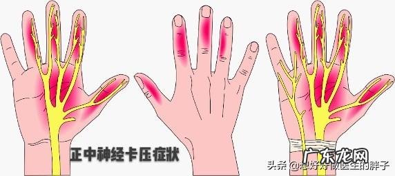 婴幼儿大拇指腱鞘炎需要手术吗?需要注意些什么?