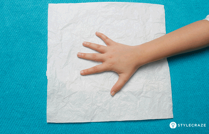 婴幼儿大拇指腱鞘炎需要手术吗?需要注意些什么?