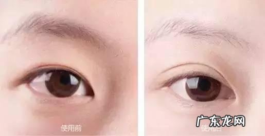 刚做完的双眼皮好肿 刚做的双眼皮晚上比较肿胀