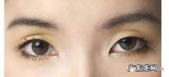 双眼皮二次修复是重新做么 双眼皮修复是重新割一个双眼皮吗