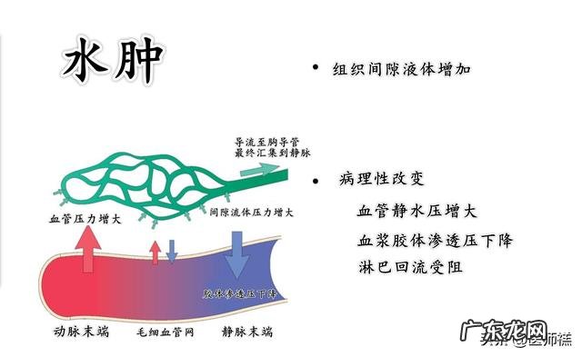 孕期为什么会水肿怎么缓解呀