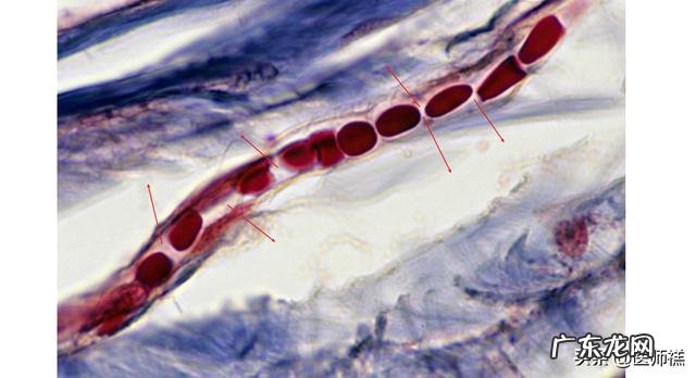 孕期为什么会水肿怎么缓解呀