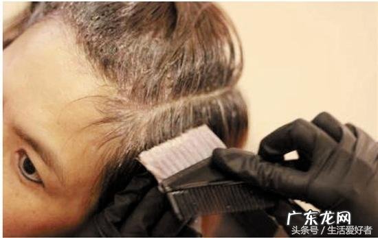 男士掉头发的解决方法 治脱发生发的简单有效方法