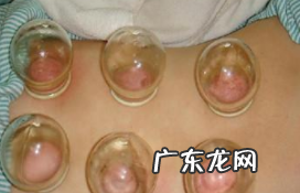 拔罐减肥的注意事项,有哪些?