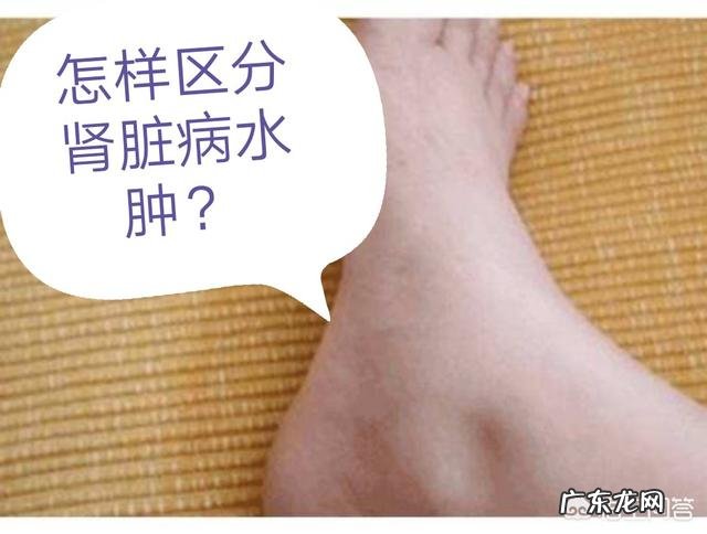 结缔组织病会导致消瘦吗?