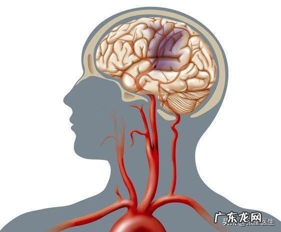 脑供血不足，会有什么表现怎么改善
