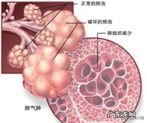 父亲有糖尿病，高血压，冠心病。腿部，下体至腰椎浮肿怎么办？