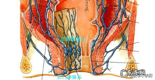 会不会后悔做过痔疮手术?