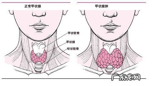 肺结节病的症状和zhi疗是什么