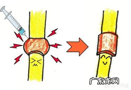 不小心患上腱鞘炎应该如何护理?